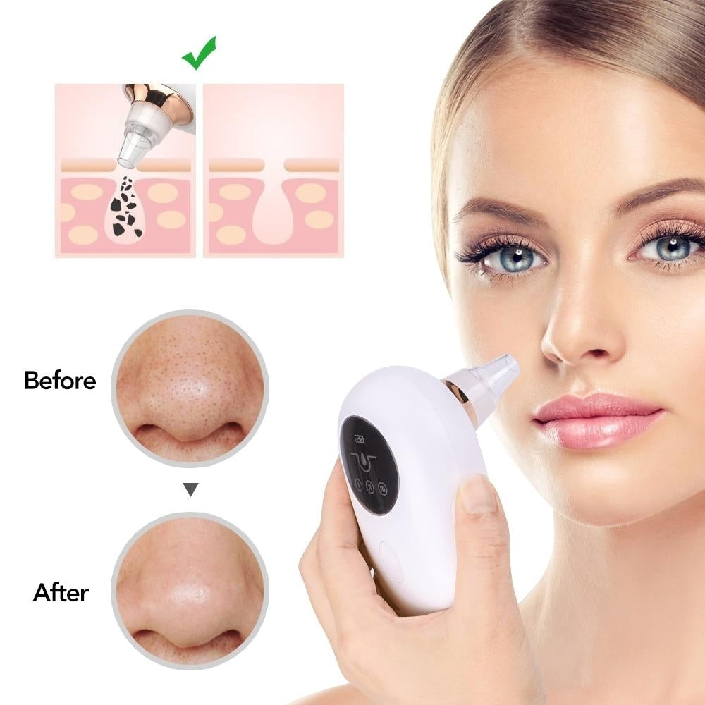Face Pore Cleaner Remover Blackhead Skin Vacuum Acne Suction Extractor (Blackhead Vacuum C) Image 4