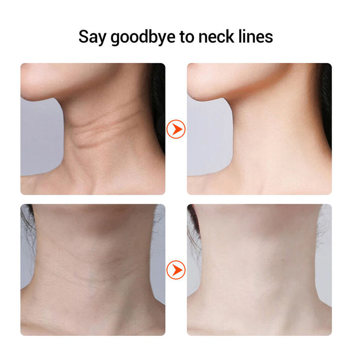 Myoglow Neck Face Lifting Device Tightening Massager Anti-Wrinkle Beauty Tool Image 6