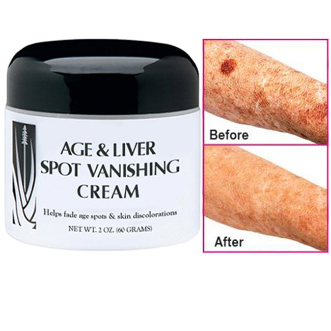Age and Liver Spot Fade Vanishing Cream Image 4