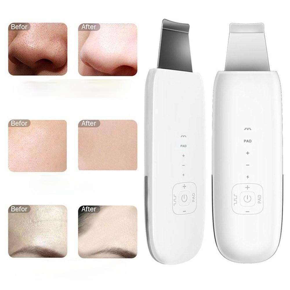 Ultrasonic Face Cleaner Skin Scrubber Care Massager Facial Tighten Anti-aging Wrinkle Removal Image 4