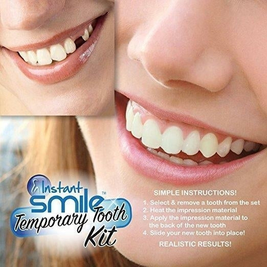 MULTI SHADE TOOTH REPLACEMENT KIT W 1 PKGS EX BEADS easy replace missing tooth Image 1