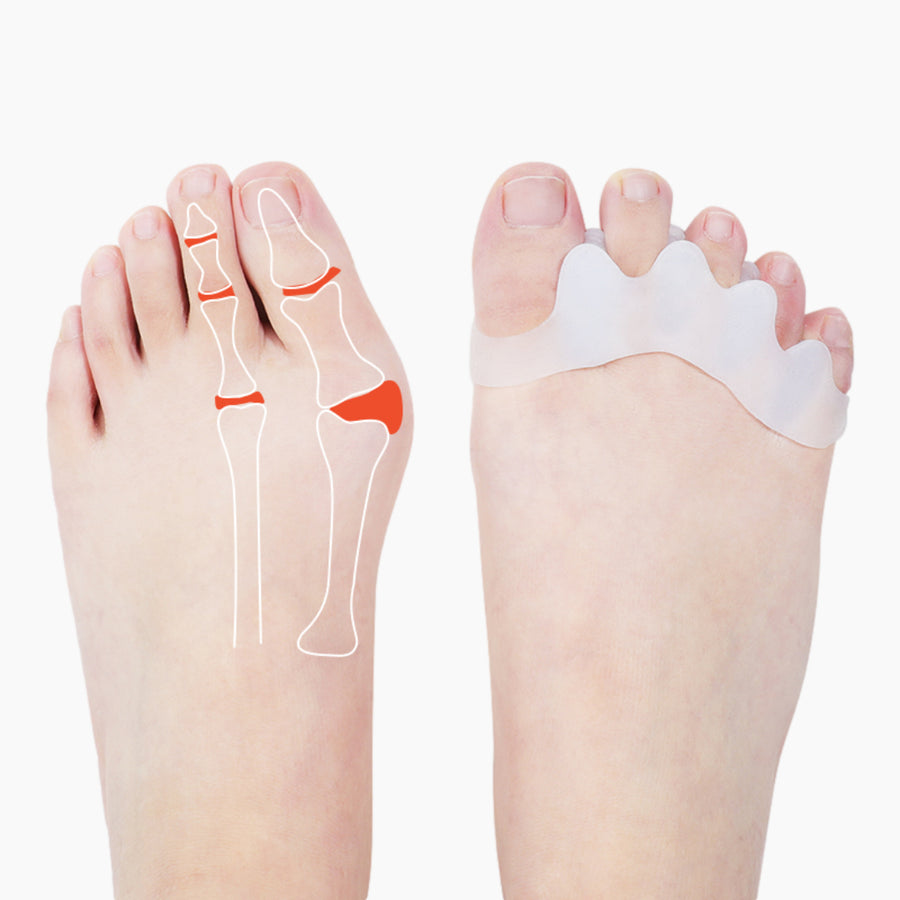 Pack of 2 Toe Separator - Gel Non Slip Bunion Toe Spacer Overlapping Hammer Toes Image 1