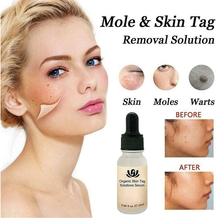2pcs Organic Tags Solutions Serum Spot Purifying Serum Mole Remover Repair Cream Oil Image 4