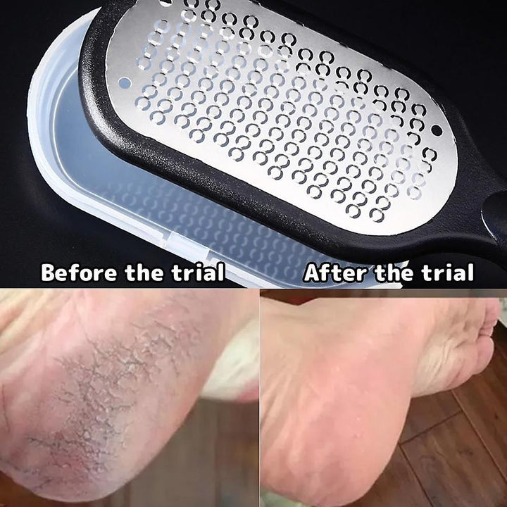 Foot Rubbing Board Dead Skin Callus Removal Foot File Scruper Foot Pedicure Tool Image 4