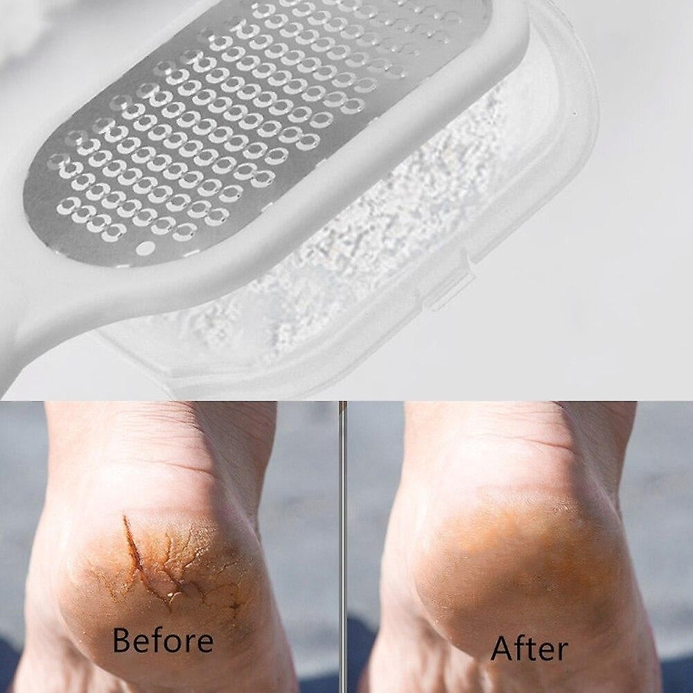 Foot Rubbing Board Dead Skin Callus Removal Foot File Scruper Foot Pedicure Tool Image 7