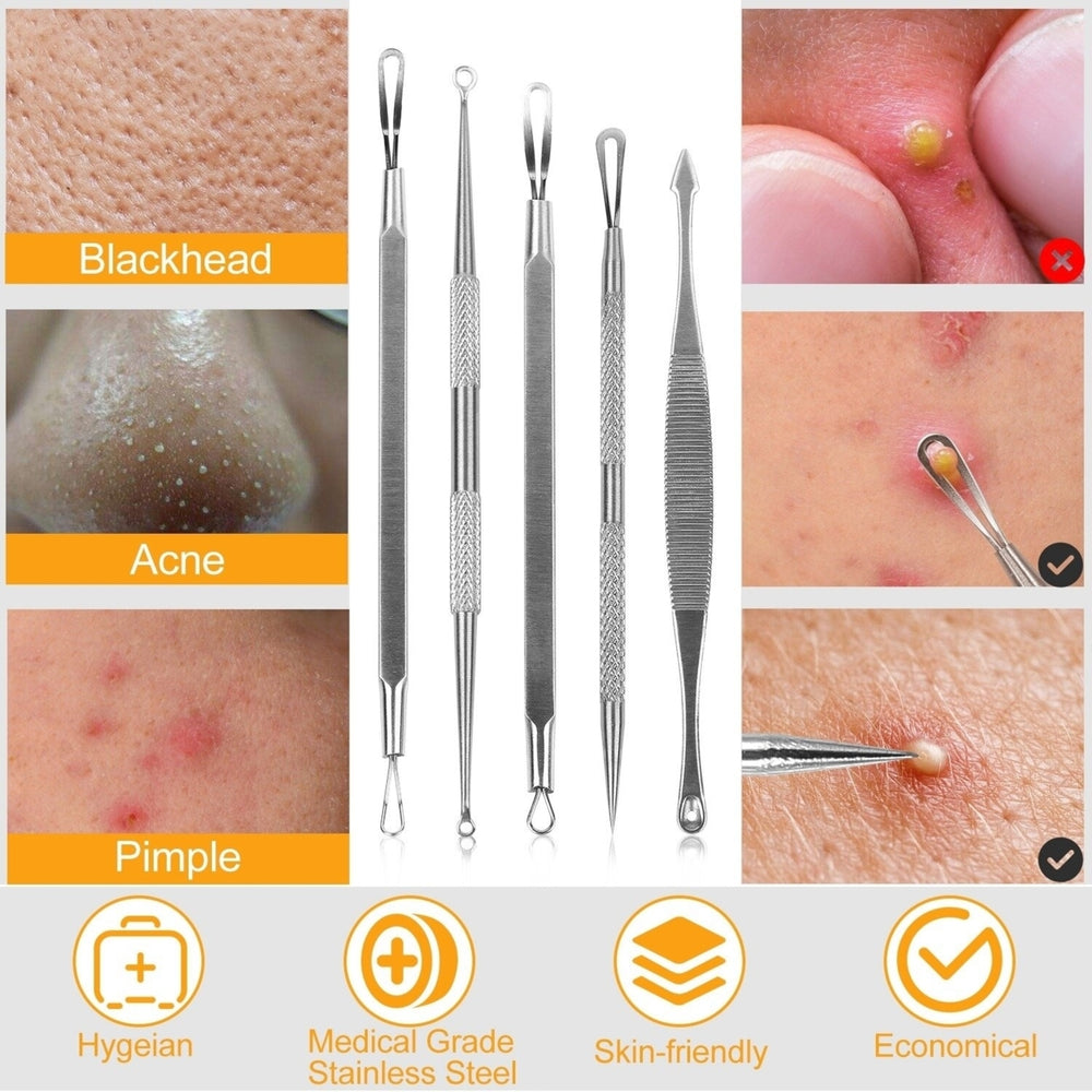 5Pcs Blackhead Remover Kit Pimple Comedone Extractor Tool Set Stainless Steel Facial Acne Blemish Whitehead Image 2