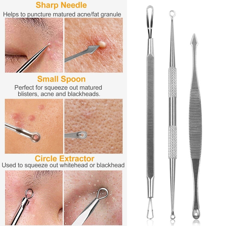 5Pcs Blackhead Remover Kit Pimple Comedone Extractor Tool Set Stainless Steel Facial Acne Blemish Whitehead Image 4