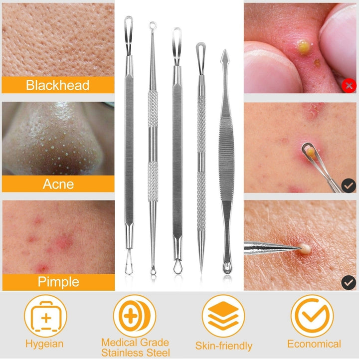 5 Pcs Blackhead Remover Kit Pimple Comedone Extractor Tool Set Stainless Steel Image 12