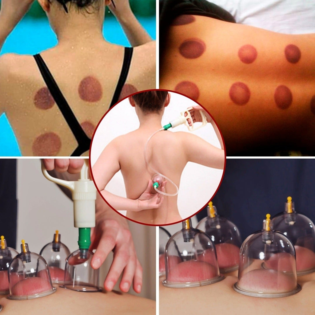 32 Cups Chinese Massage Therapy Cupping Set Body Vacuum Suction Kit Acupoint Massage Kit Image 6