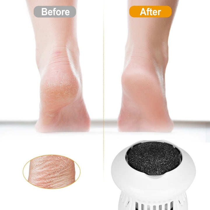 Electric Callus Grinder USB Rechargeable Foot File Callus Remover Vacuum Feet Pedicure Exfoliating Image 4