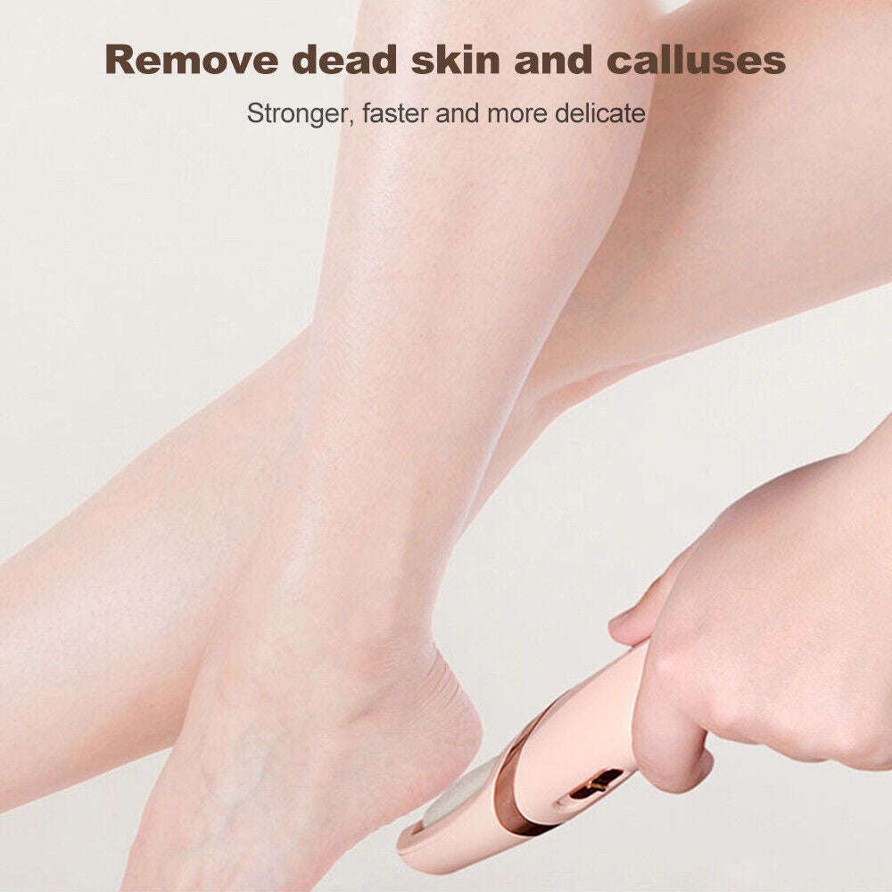 Rechargeable Electric Foot Callus Remover Image 4