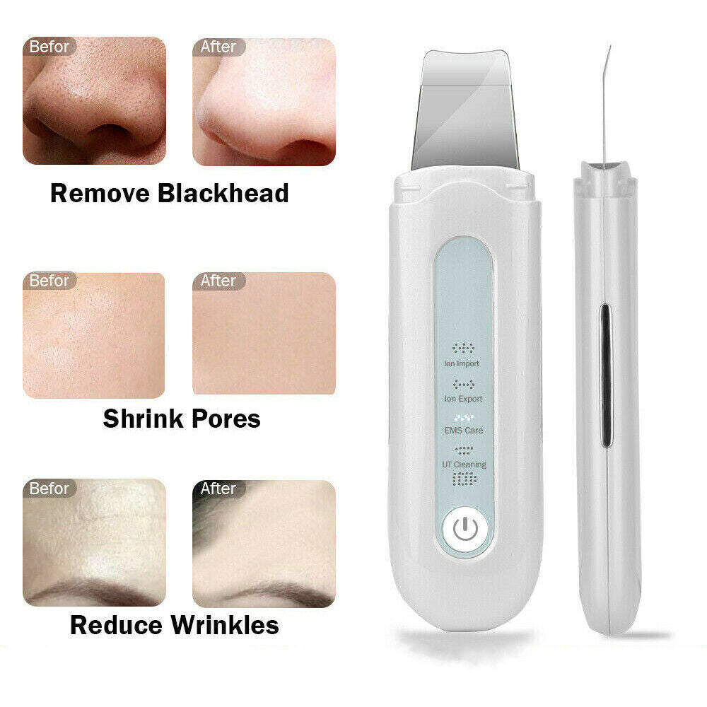 Ultrasonic Skin Scrubber Blackhead Peeling Remover Facial Peeling Deep Cleaner Image 4