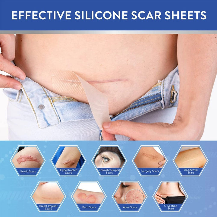 1Roll Professional Silicone Scar Sheets Scars Treatment - Reusable Silicone Scar Strips Type for Image 3