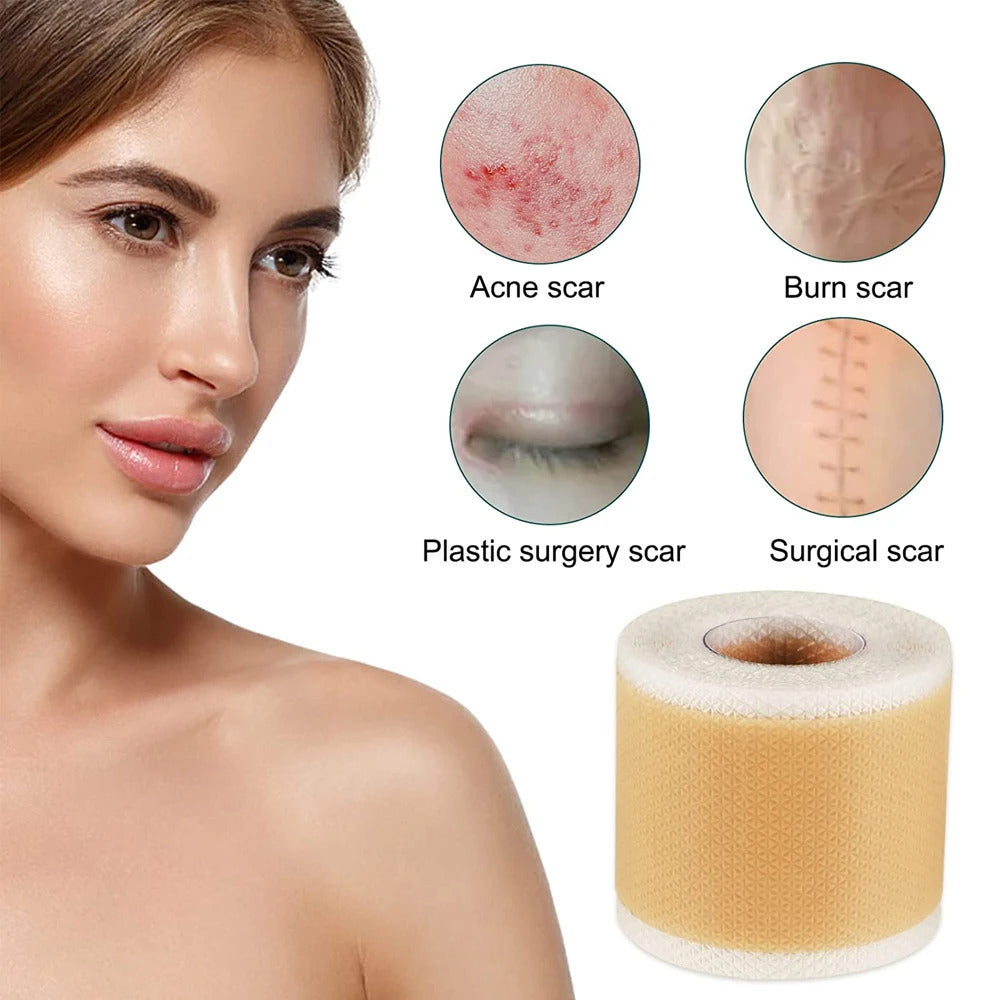 1Roll Professional Silicone Scar Sheets Scars Treatment - Reusable Silicone Scar Strips Type for Image 4