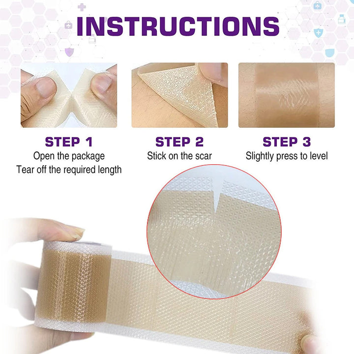 1Roll Professional Silicone Scar Sheets Scars Treatment - Reusable Silicone Scar Strips Type for Image 7