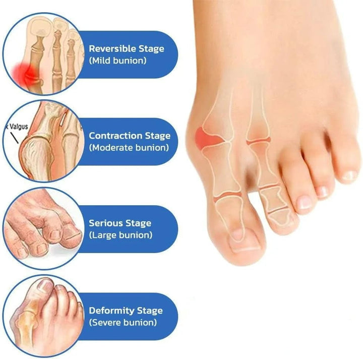 Anti-Bunion and Vein Health Socks for Women and Men Image 9