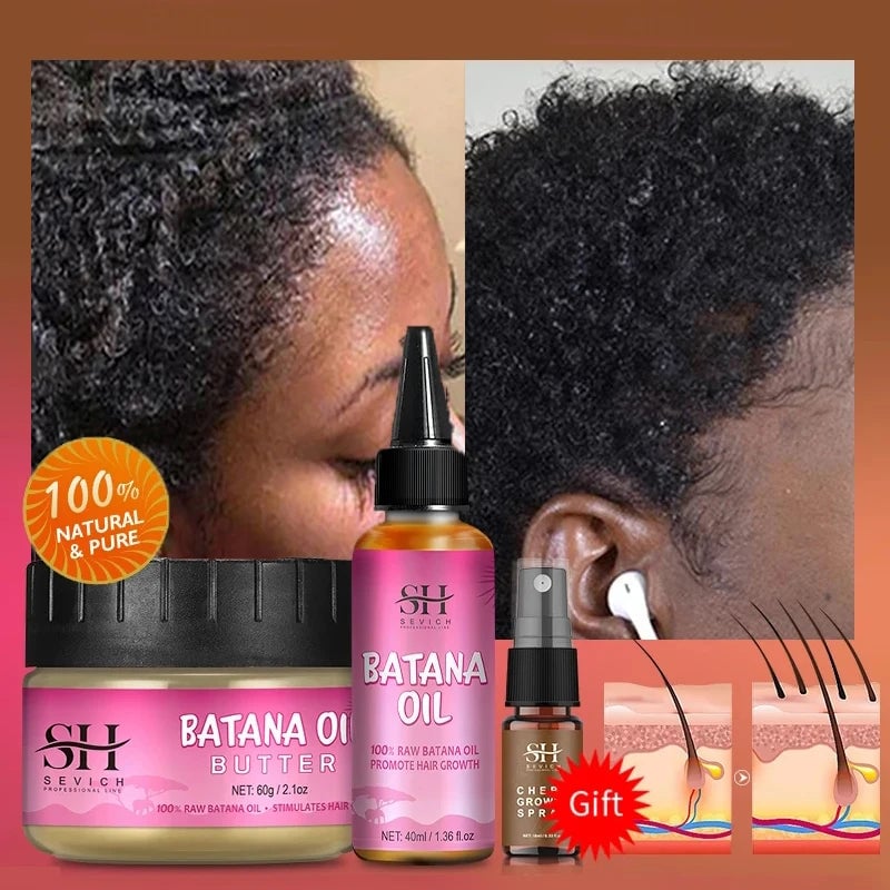 Fast Hair Growth Set Batana Oil Traction Alopecia Hair Mask anti Break Loss Hair Growth Oil Baldness Treatment Batana Image 2