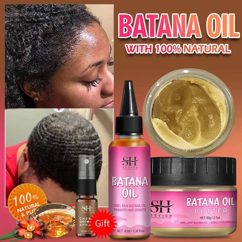 Fast Hair Growth Set Batana Oil Traction Alopecia Hair Mask anti Break Loss Hair Growth Oil Baldness Treatment Batana Image 6