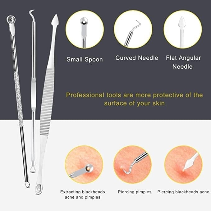 10-Piece: Blackhead Remover Tool Image 4