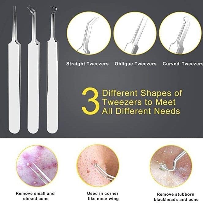 10-Piece: Blackhead Remover Tool Image 4