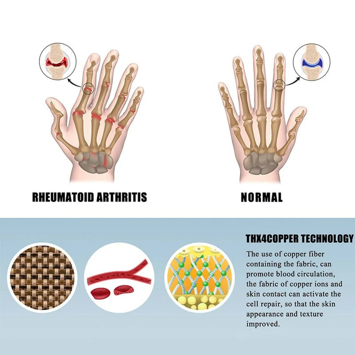 2-Pairs: Rheumatoid Arthritis Magnetic Compression Gloves Image 4