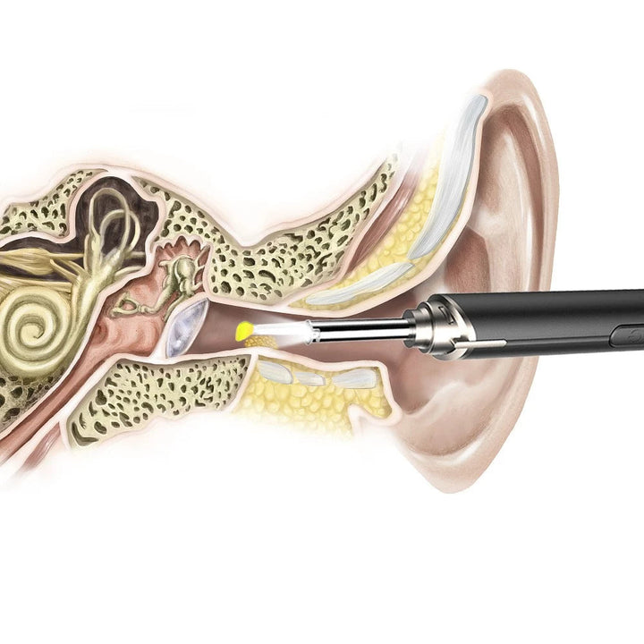 Intelligent Visual Ear Otoscope Inspection Tool Image 4