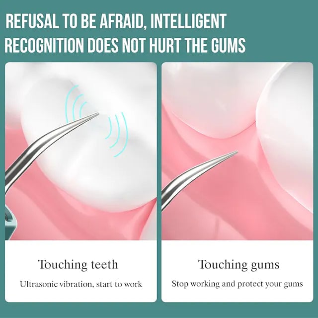 Visual Ultrasonic Teeth Cleaner Image 8