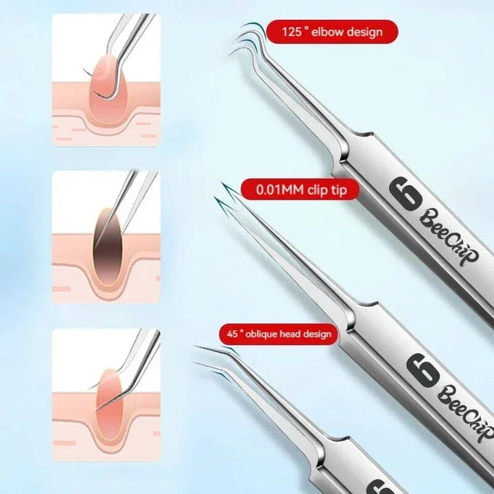 3PCS Facial Pore Cleaning Tools Ultra-Fine Stainless Steel Tweezers Clamps Image 4