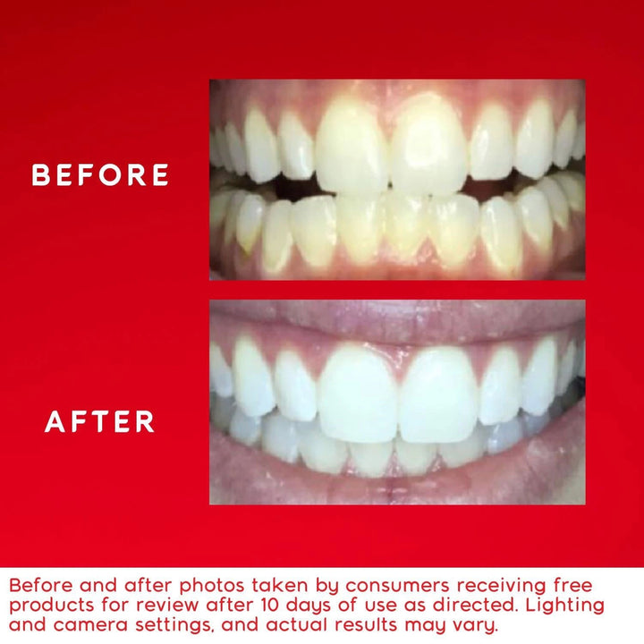 Colgate Optic White ComfortFit Teeth Whitening Kit Image 4