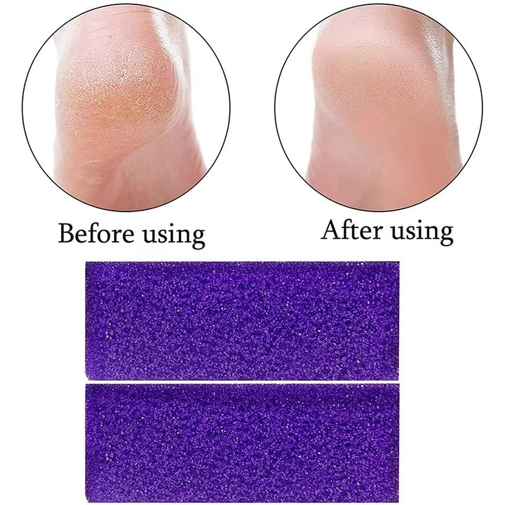 Foot Pumice Grinding Stone Scrub Hard Dead Skin Remover Double Sided PU Reusable Image 6